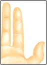 Image of flexor tendon