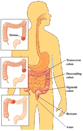 Cutaway view of intestine and colon
