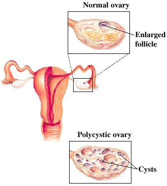 Cutaway view of ovary