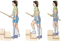 Image of woman on crutches