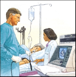 Image of patient during a TEE