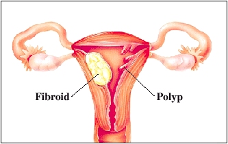 Cutaway view of uterus