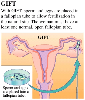 Cutaway view of uterus