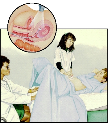 Performing the procedure