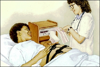 Woman with fetal heart monitor