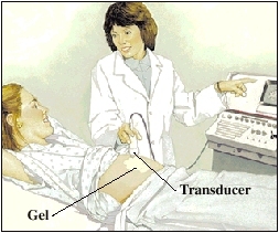 Woman undergoing ultrasound test.