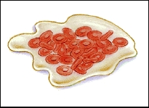Normal blood cell