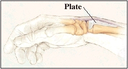 Hand with plate