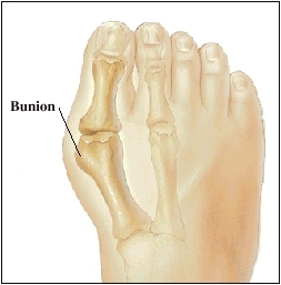 Cutaway view of foot