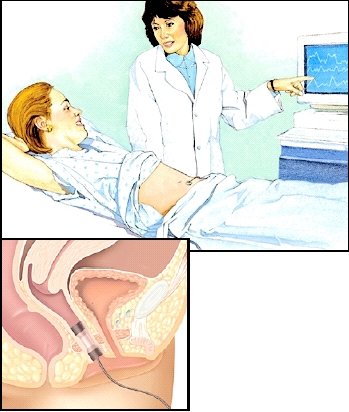 Images of procedure