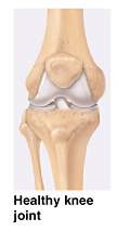Image of healthy knee joint