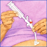 Image of procedure