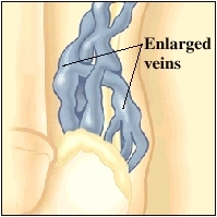 Cutaway view of veins
