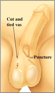 Cutaway view of testicles and vas