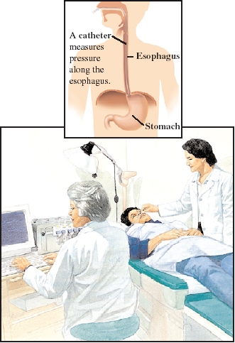 Image of the procedure