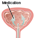 Cutaway view of bladder