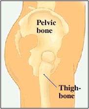 Cutaway view of hip