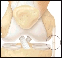 Cutaway view of knee