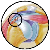 Cutaway view of rotator cuff