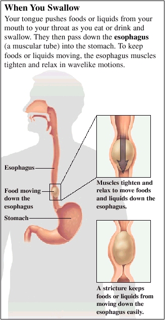 Cutaway view of esophagus