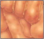 Image of stomach lining