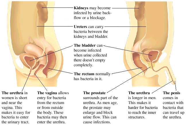 Cutaway view of urinary tract