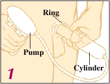 Image of pump and penis