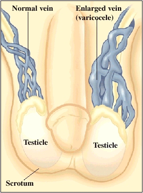 Cutaway view of testicles