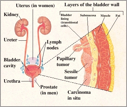 Cutaway view of urinary tract