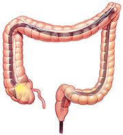 Lower digestive tract